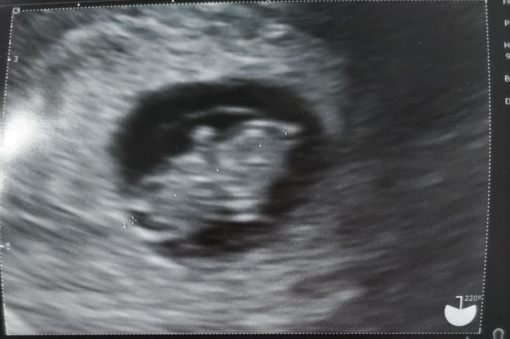 我が子成長してきました👶