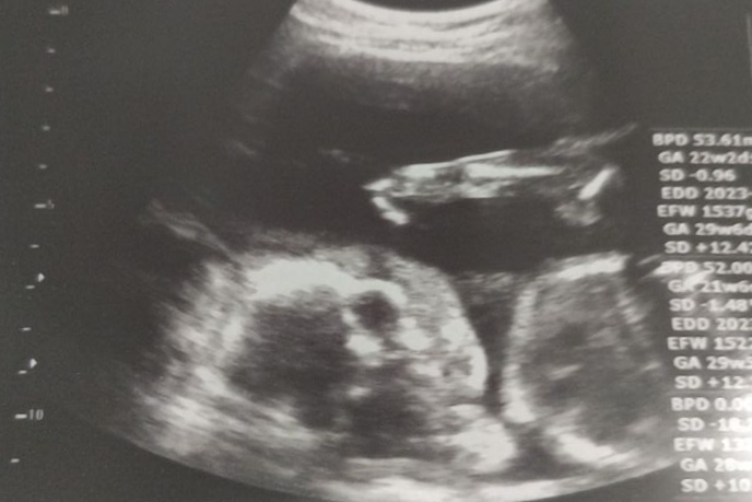 性別ほぼ確実！？👶